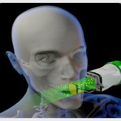 Intraorale rntgenoptagelser med firkantet tubus
